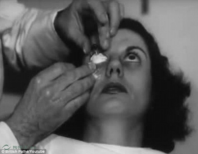 The cringeworthy video shows him place a white material onto the woman's anaesthetized eye (pictured)